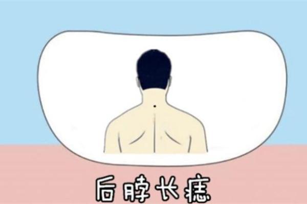 男人背上有痣，财运亨通的秘密！