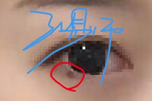 双眼皮上的神秘符号，这颗痣为何让人过目难忘？