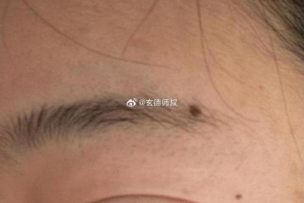 痣中藏故事，左眉尾痣女主的神秘身份曝光