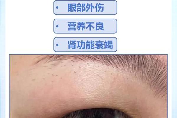 眼睑肿大，揭秘颜值杀手的秘密