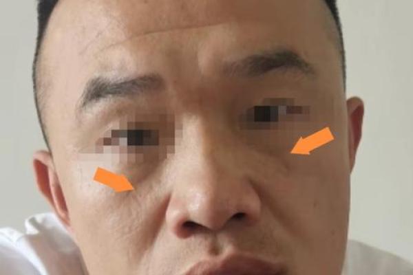 面相揭秘：凹陷轮廓背后的命运暗示