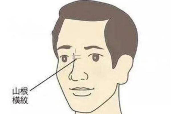 面相解析：山根断裂男性的命运启示
