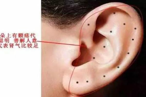 耳垂痣是福是祸？麻衣神相为你揭开面纱
