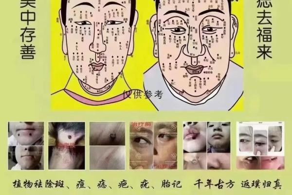 痣相奇谈：痣的位置决定你的财运、事业运！
