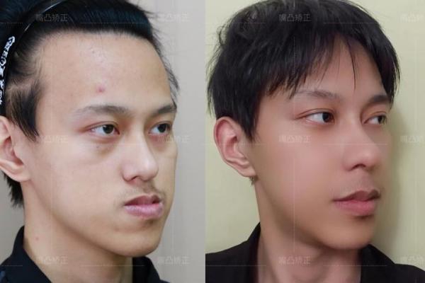 地包天嘴面相揭秘：命运多舛的象征？