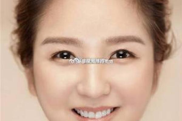 眼角痣的秘密：内眦肉长痣的眼相解析