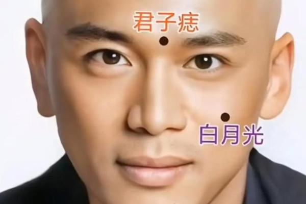 眼角痣的秘密：内眦肉长痣的眼相解析