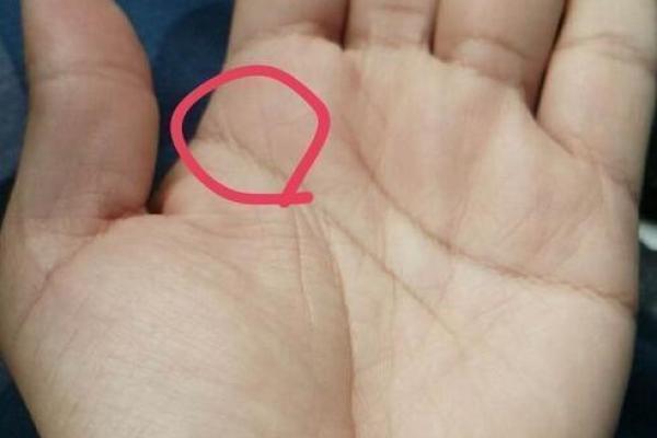 颈纹揭秘：隐藏的命理密码，你的运势如何？