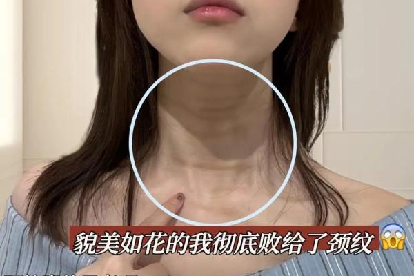 颈纹揭秘：隐藏的命理密码，你的运势如何？