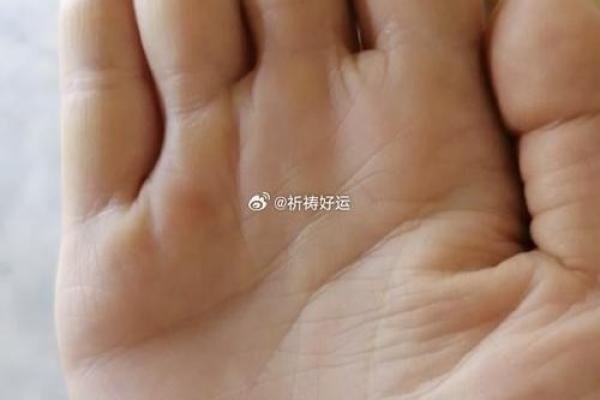 解锁命运密码：柳庄神相痣相图大揭秘