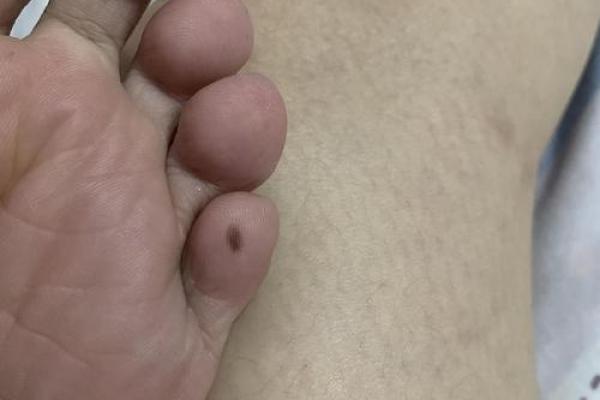 脚底痣宝宝，心相之谜等你解