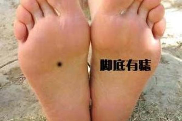 脚底痣宝宝，心相之谜等你解