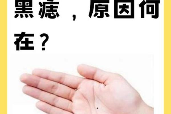 神秘右手背痣相女人，揭秘她的命运之谜！