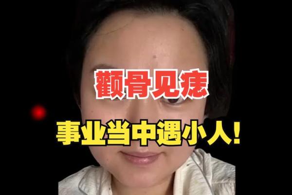 男子踩中小人痣，好运连连，揭秘奇人奇事！
