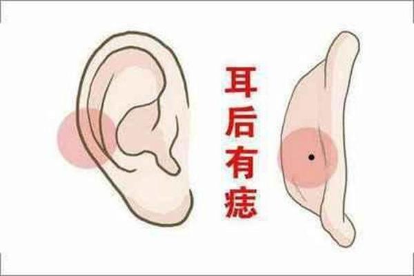 耳长痣的运势解读：揭秘你的人生财运密码！