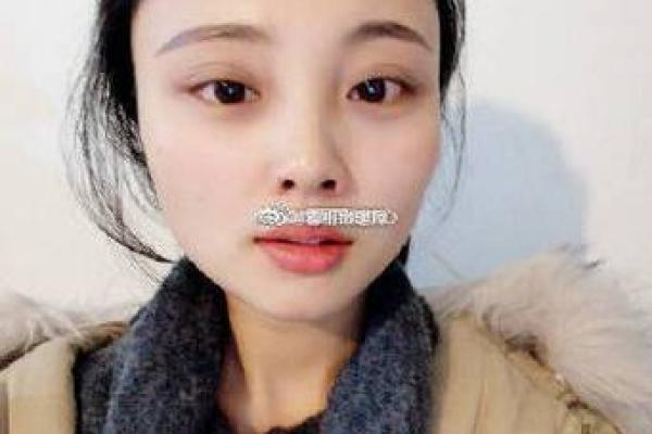 额头左发里痣相大揭秘，让你财运亨通、事业有成！