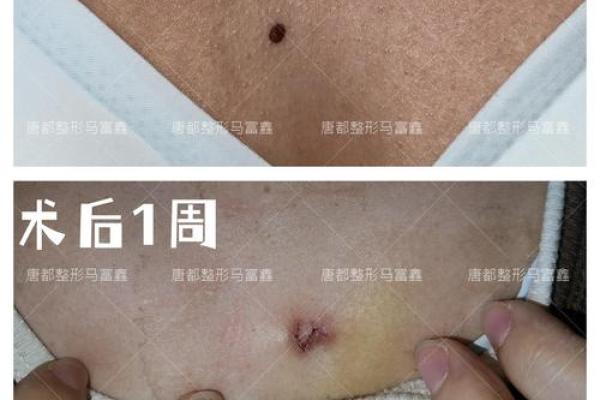 痣在左胸，女人味十足！快来发现这个独特的美学亮点！