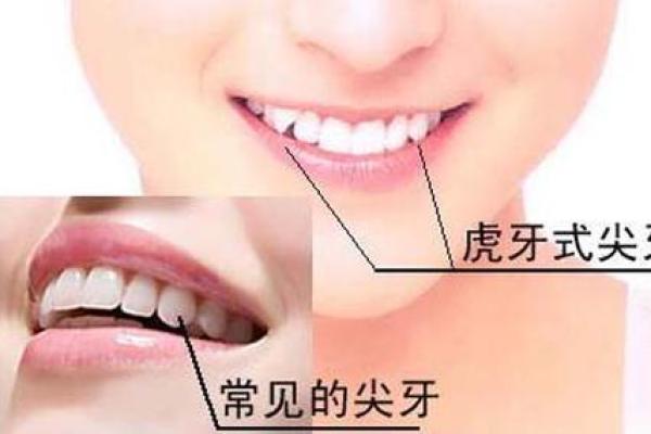 牙齿泄露的面相秘密
